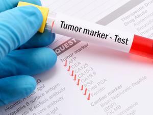 Tumor marker test and results