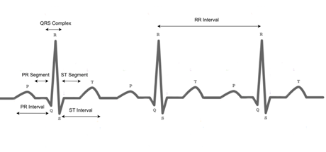 sinusrhythmlabels